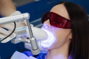 whitening teeth procedure during visit at dentist 2022 01 21 19 53 16 utc 1