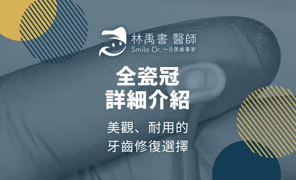 Read more about the article 全瓷冠詳細介紹：美觀、耐用的牙齒修復選擇